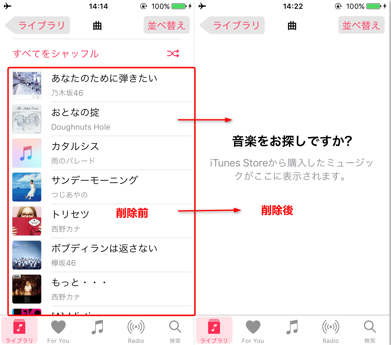 iPodの曲がAnyTransで削除された