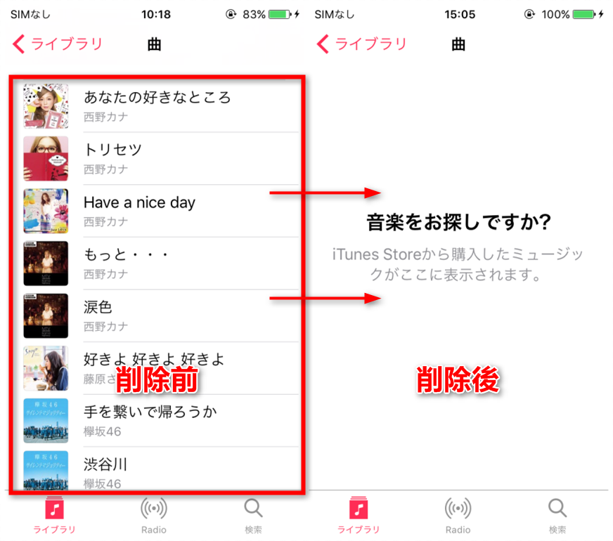 iPodの曲がAnyTransで削除された
