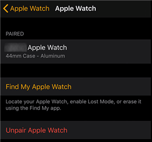 Apple Watch Ayrıntılarını Görüntüleyin